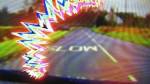 scintillating-scotoma